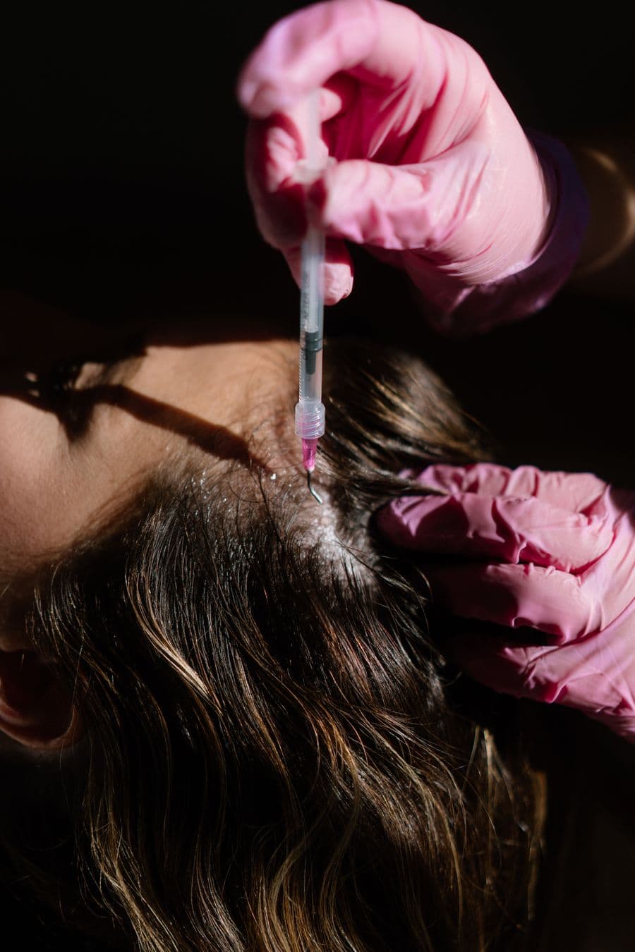 Serum applied to the scalp during a Wellspring treatment
